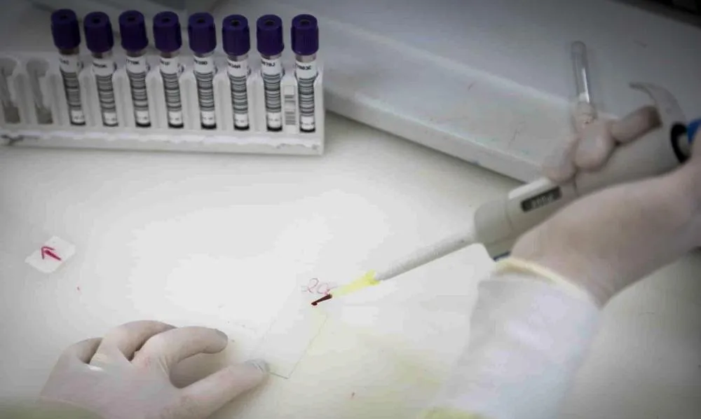 Exames descartam suspeita de ebola em paciente internado no RJ